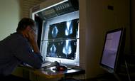 Inden for få år vil radiologer få hjælp af computersystemer med kunstig intelligens, der i forsøg har vist sig at være mere fejlfri end mennesker. Foto: AP/Damian Dovarganes
